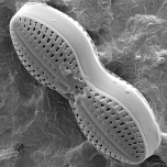 Diatom